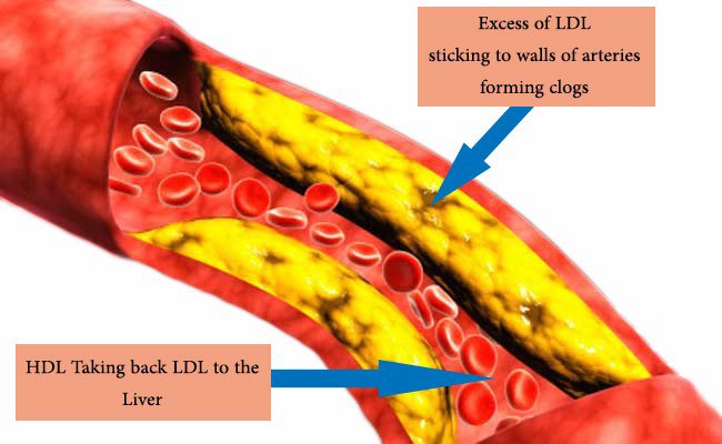 Chỉ số LDL cholesterol trong máu là gì?